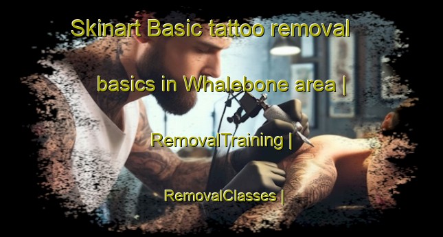 Skinart Basic tattoo removal basics in Whalebone area | RemovalTraining | RemovalClasses | SkinartTraining-United Kingdom
